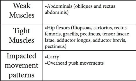 t:w lordosis1